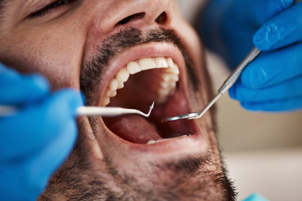 Best Urgent Care for Lost Fillings or Crowns in West Hills, PA